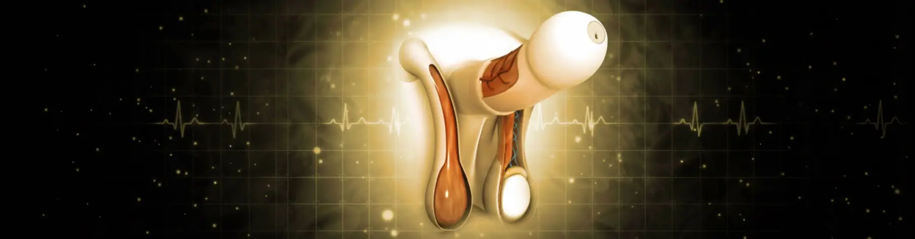 Penile Implant Surgery in Lucknow