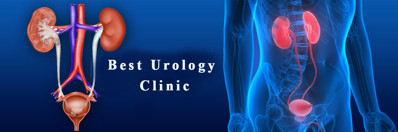 best urologist doctor in lucknow,best urologist in lucknow,kidney specialist in lucknow,kidney stone doctor in lucknow,kidney stone removal in lucknow,
kidney stone specialist  in lucknow,kidney stone treatment in lucknow,kidney transplant surgeon in lucknow,kidney Transplantation in Lucknow,
LASER kidney stone treatment in lucknow,LASER prostate surgery in lucknow,Male infertility treatment in lucknow,Male sexual disorder treatment in lucknow,
online urologist in lucknow,online urology consultation in lucknow,premature ejaculation treatment in lucknow,prostate surgery doctor in lucknow,
prostate surgery in lucknow,urologist in lucknow.