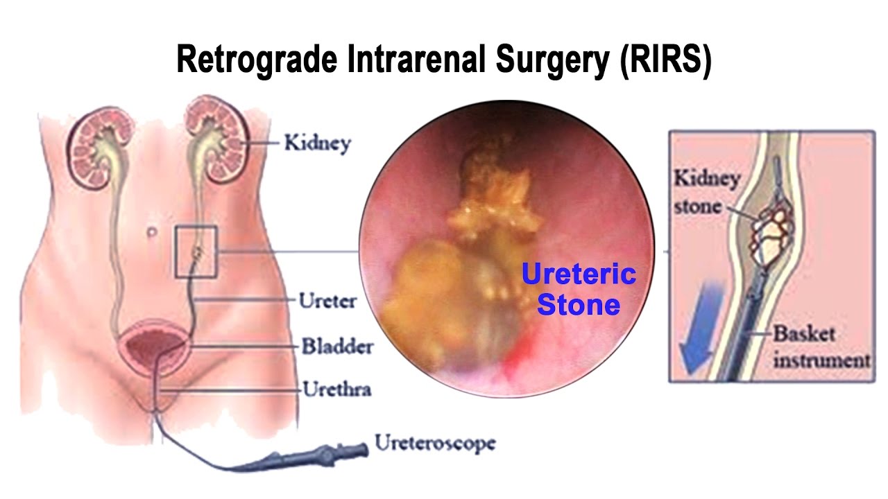 Urology Clinic Dr Praveen